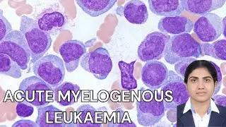 Acute Myelogenous Leukemia (AML): FAB, WHO & Auer Rods Explained | Hematology #symptoms & diagnosis