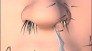 ✅Face Clinic New levels game mobile Walkthrough
