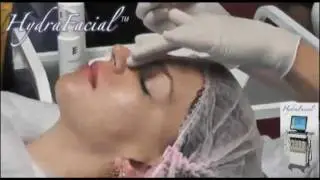 косметологический аппарат HydraFacial часть 2