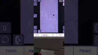 Coilling procedure for brain