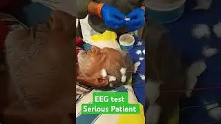 EEG (Neuro) test for seizure disorder! old age Patient!  #eeg #seizuredisorder #shorts #viralvideo