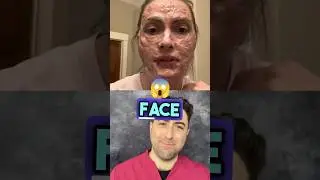 What&rsquo;s gone WRONG with this gelatin face mask ?