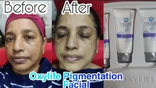 Oxylife Pigmentation Facial kit | treatment facial | Salon style facial 💆@sarbani'zmakeupndlifestyle
