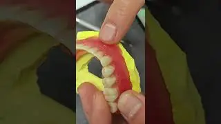 Broken Denture? Here&rsquo;s What to Do IMMEDIATELY! #dentist #satisfying #asmr