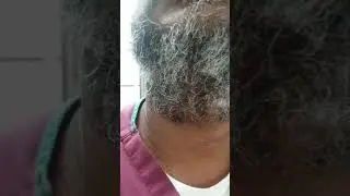SACRED SCROLLS OF REVELATION : HAIR LIKE WOOL CH 1 VS 14, 15