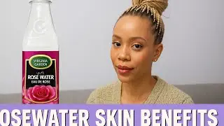 ROSE WATER for Clear Skin! 💧 Acne, Sunburn & Anti-Aging Benefits You Need to Know