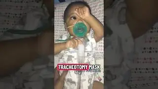 What Breathing Sounds Like with an Infant Baby Trach Mask | Pediatric Tracheotomy | #littlelungs