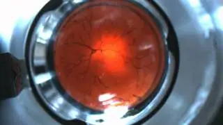 Untethered magnetic end-effector steered in model eye in OctoMag magnetic steering system