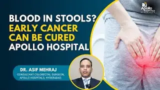 Early Colorectal Cancer Diagnosed and Treated with Laparoscopic Surgery | Dr. Asif Mehraj