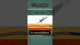IV cannulation | Iv cannula kese lgae?💉#3d #animation #medical #viral #shortsvideo #trending