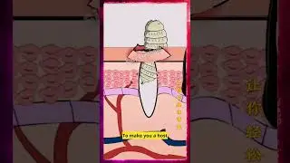 #s307 | Horsefly larvae