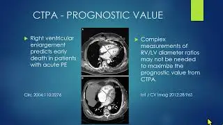 037 MDCT Evaluation of the Patient with Acute Chest Pain Freemedbooks.com