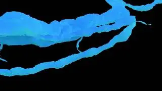 LPSP wide neuroanatomy