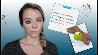 ИСТОРИЯ | МОИ ТРАВМЫ *ой!*
