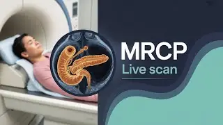 Mastering the MRCP: How to Scan Without Contrast