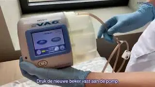 Acti V.A.C. opvangbeker wisselen