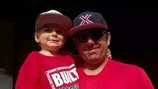 2018 Xtreme Baseball Hype