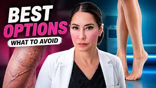 The Best Treatments for Varicose Veins (and What to Avoid)
