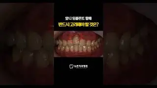 [부산임플란트치과] 앞니 임플란트 할 때 반드시 고려해야 할 것은 ? #dentist