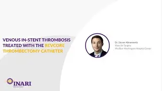 Venous in Stent Thrombosis Treated with the RevCore Thrombectomy Catheter
