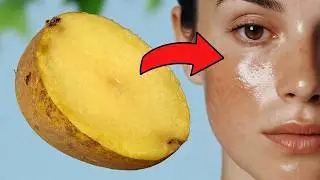 PATATA rimedio naturale per le macchie della pelle in 20 minuti 🌿