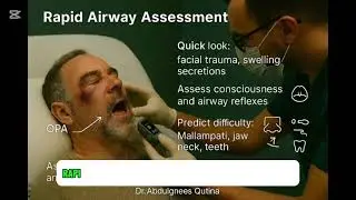 Rapid Airway Assessment in Emergency Medicine | ICU & ER Airway Skills 🫁⚡