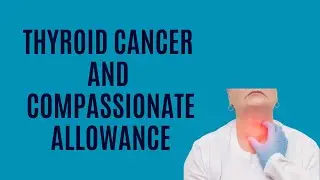 When Does Thyroid Cancer Qualify for Compassionate Allowance?
