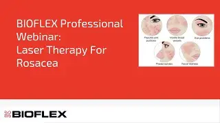 Laser Therapy For Rosacea