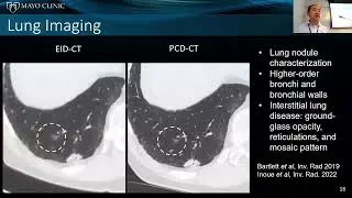 (Invited Talk) Photon counting detector computed tomography: clinical applications