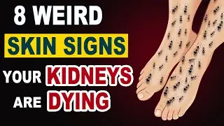 8 Weird Skin Signs of Kidney Damage You Must Not Ignore