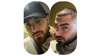 Thibault se fait faire des implants capillaires ...😏