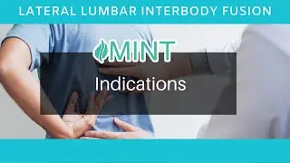 Lateral Lumbar Interbody Fusion in Dallas TX: Indications &ndash; Dr. Scott Kutz | (972) 244-3491