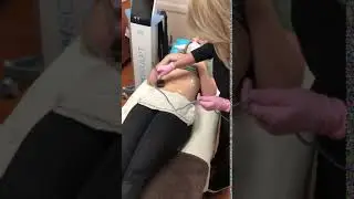 Non Surgical Skin Tightening - Forma Plus