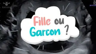 FILLE OU GARCON ? D&eacute;couvrez la m&eacute;thode du BOURGEON GENITAL pour conna&icirc;tre le sexe de b&eacute;b&eacute; !