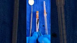What&rsquo;s inside a fake c1garette? #fruitsurgery #asmr #satisfying #DiscountDentist #FilmProps