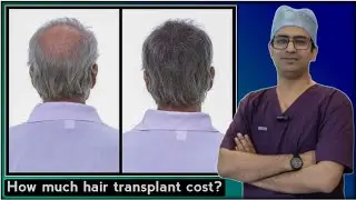 COST OF HAIR TRANSPLANT ( THE SKIN CENTRE )  DR. ABHINAV KUMAR/ KANKARBAGH PATNA - 800020