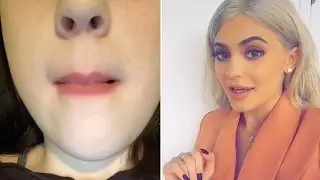 Girl's Lips Get STUCK TOGETHER from buying Kylie Lip Kit From Fake Website!