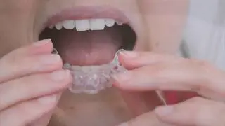 Retainer Care
