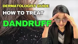Why Your Dandruff Is Not Going Away | Biggest Mistakes People Make | Dermatologist Explained