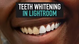 Quick Natural Teeth Whitening Technique in Adobe Lightroom - Easy Tutorial