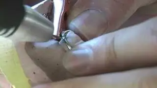 Orion Dental Welders - Partial Clasp Repair