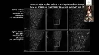 Linjing Fang - Deep learning-based point scanning super resolution imaging - Imaging ONEWORLD