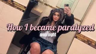 The Accident That Changed My Life Forever&hellip;