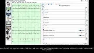 Natus EEG Tutorial: NeuroWorks 9 Physiological Monitoring Integration in ICU