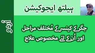Liver Cancer: Different Stages & Treatment Options | Urdu || Prof. Dr. Javed Iqbal FAROOQI
