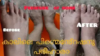 how to remove pigmentation on legs~കാലിലെ കറുപ്പു൦ പിഗ്മെ൯േ്റഷനു൦ മാറ്റാ൦#pedicureathome#dailyvideos