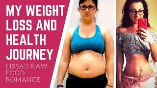 73lbs WEIGHT LOSS HEALTH TRANSFORMATION || ACNE + CELLULITE GONE || DIET