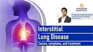 Understanding Interstitial Lung Disease (ILD) |  Yashoda Hospitals Hyderabad |