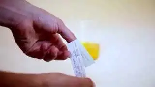 Hormone testing: Urine Collection