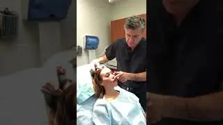 Lip Lift Procedure with Dr. Milgrim Part 1: Getting Ready